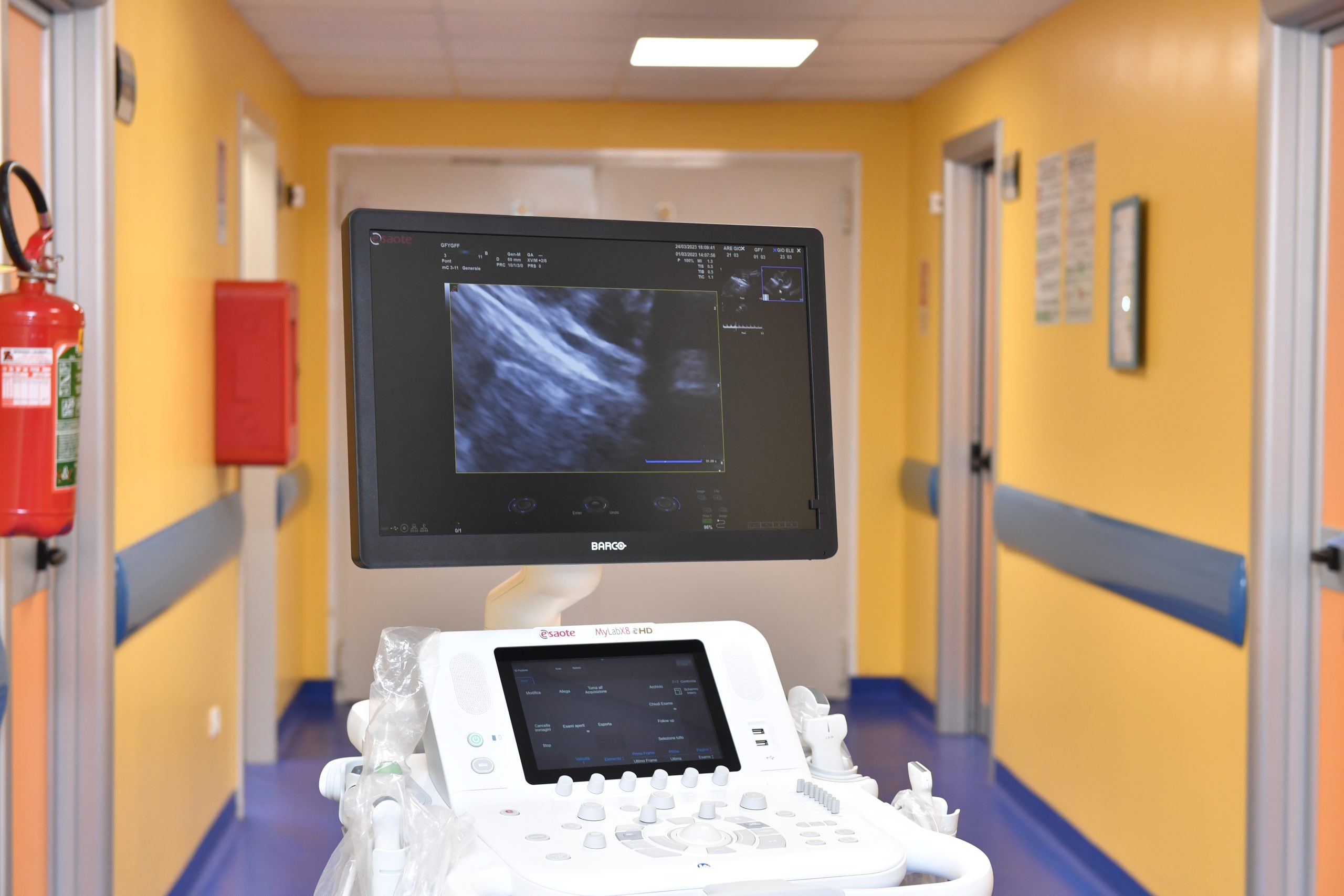 Ecotomografo Pronto Soccorso2